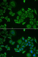 C1D Polyclonal Antibody