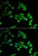 MYOZ2 Polyclonal Antibody