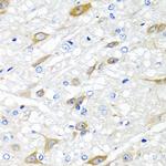 CPA6 Antibody in Immunohistochemistry (Paraffin) (IHC (P))