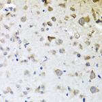 CPA6 Polyclonal Antibody