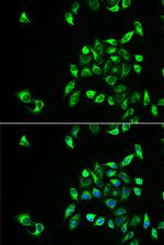 CSNK1A1L Polyclonal Antibody