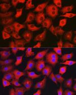 GAMT Polyclonal Antibody