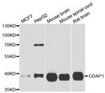 GDAP1 Antibody in Western Blot (WB)