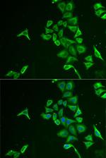INPP5J Polyclonal Antibody
