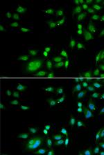 INTS10 Polyclonal Antibody