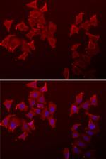 LECT1 Polyclonal Antibody