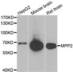 MPP2 Polyclonal Antibody