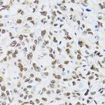 MTA3 Polyclonal Antibody