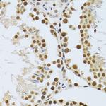 MTA3 Antibody in Immunohistochemistry (Paraffin) (IHC (P))
