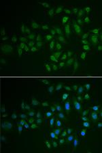 MLCK Polyclonal Antibody