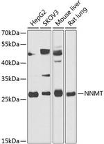 NNMT Polyclonal Antibody