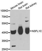 NSFL1C Polyclonal Antibody
