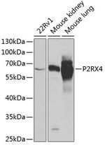 P2X4 Polyclonal Antibody