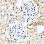 PNK Antibody in Immunohistochemistry (Paraffin) (IHC (P))