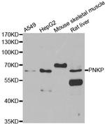 PNK Antibody in Western Blot (WB)