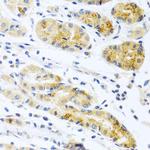 PROK2 Polyclonal Antibody