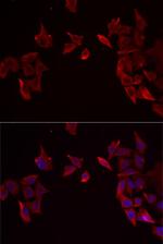 RAMP3 Polyclonal Antibody