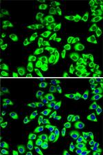 RPL14 Polyclonal Antibody