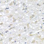 RPLP1 Antibody in Immunohistochemistry (Paraffin) (IHC (P))