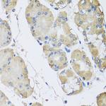 RPLP1 Polyclonal Antibody