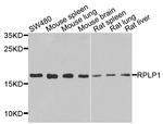 RPLP1 Antibody in Western Blot (WB)