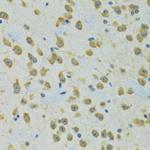 RPS7 Antibody in Immunohistochemistry (Paraffin) (IHC (P))