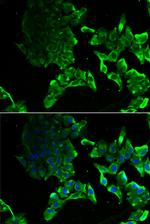 SCYL1 Polyclonal Antibody