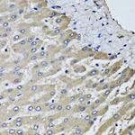 SCYL1 Antibody in Immunohistochemistry (Paraffin) (IHC (P))