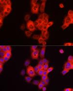 TDO2 Polyclonal Antibody