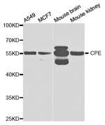 Carboxypeptidase E Antibody in Western Blot (WB)