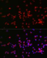 Nogo Receptor Polyclonal Antibody