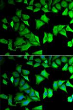 RPS12 Polyclonal Antibody