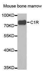 C1r Antibody in Western Blot (WB)