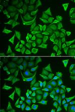 DTYMK Polyclonal Antibody