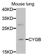 Cytoglobin Polyclonal Antibody