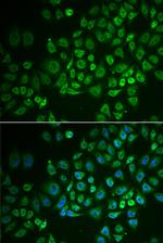 GPLD1 Polyclonal Antibody