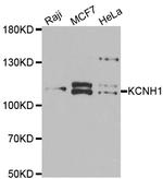 KCNH1 Polyclonal Antibody