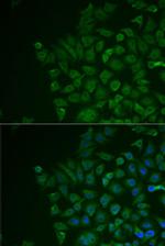 LRAT Polyclonal Antibody