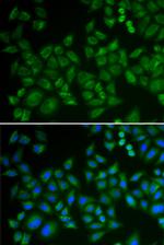 ASM Polyclonal Antibody