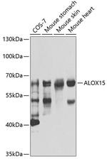 ALOX15 Polyclonal Antibody