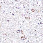 APLP1 Antibody in Immunohistochemistry (Paraffin) (IHC (P))