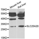 SLC25A20 Polyclonal Antibody