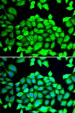 CLCN7 Polyclonal Antibody