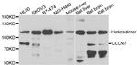 CLCN7 Antibody in Western Blot (WB)