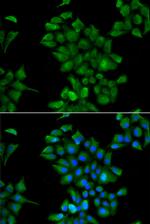 CTNS Polyclonal Antibody