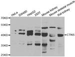 CTNS Antibody in Western Blot (WB)