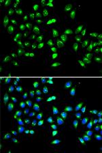 GALNT2 Polyclonal Antibody