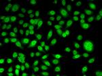 Periplakin Polyclonal Antibody