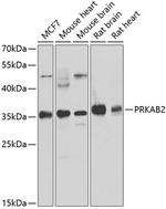 AMPK beta-2 Antibody in Western Blot (WB)