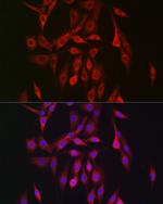 AMPK beta-2 Polyclonal Antibody